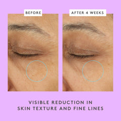 Drunk Elephant Ceramighty AF Eye Balm - Moisturizing Eye Cream - Clean Clinical Skincare 4.4 4.4 out of 5 stars (137)