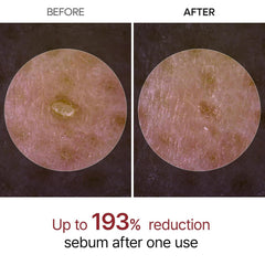 Dr.Melaxin Peel Shot Glow White and Black Rice Ampoule Duo, Soft Exfoliating Face and Body Scrub Dead Skin Cells