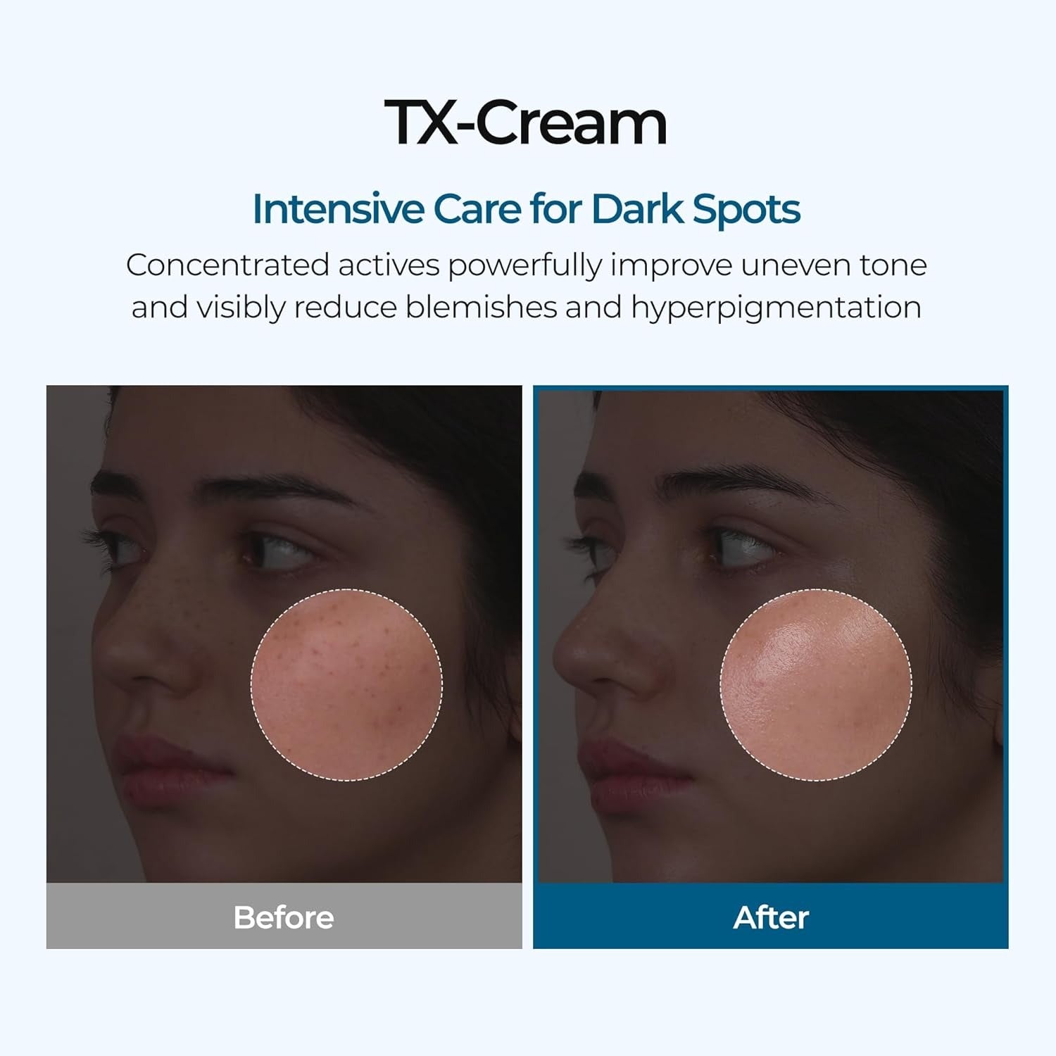 DR.Melaxin TX Tranexamic Acid CREAM