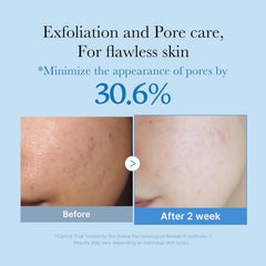 medicube Zero Pore Toner I Exfoliating & Hydrating Blue Bottle
