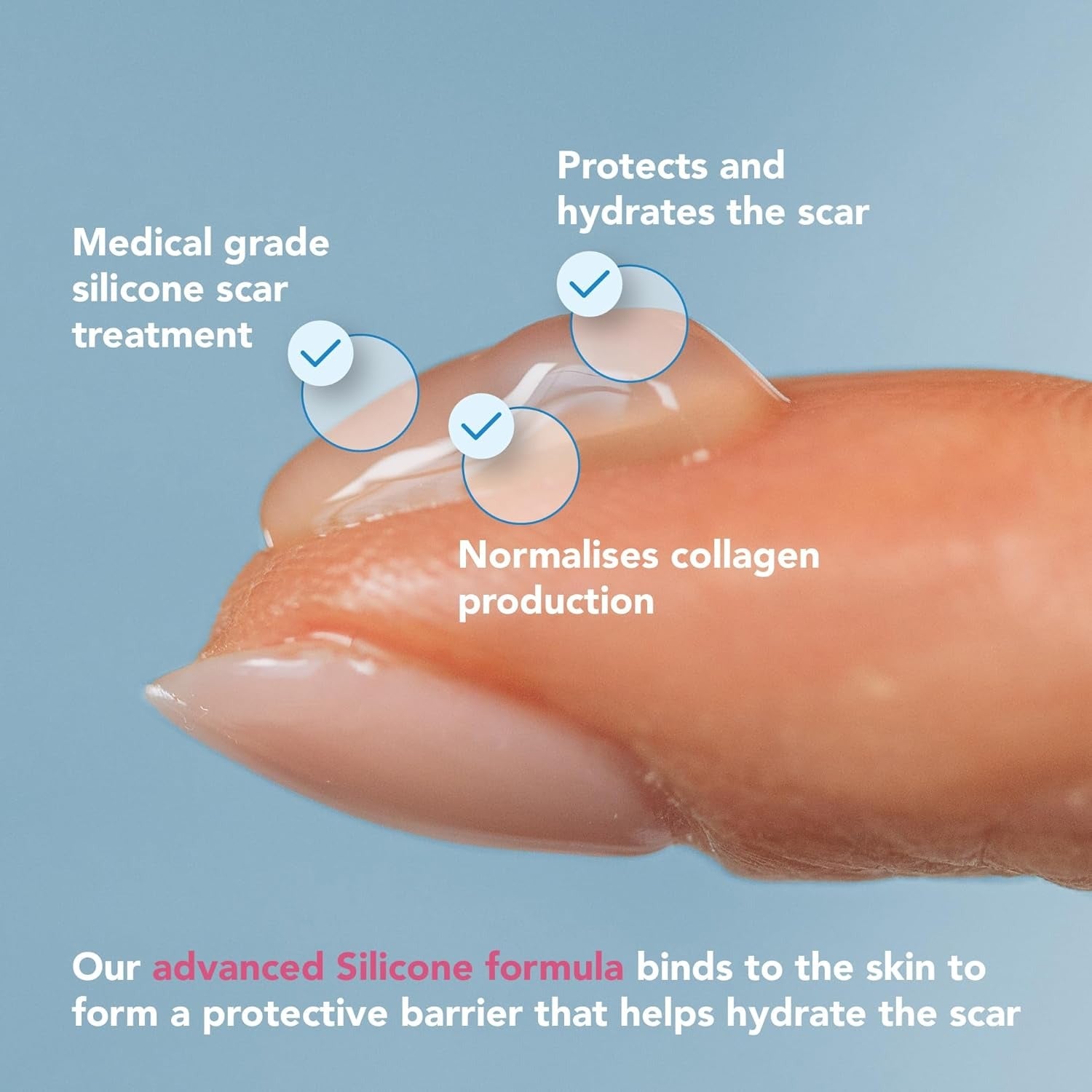 Sinclair Kelo-Cote Gel for Scars 0.53 Oz (Pack of 1)