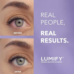 LUMIFY Eye Drops for Red Eyes, Redness Reliever for Brighter Looking Eyes